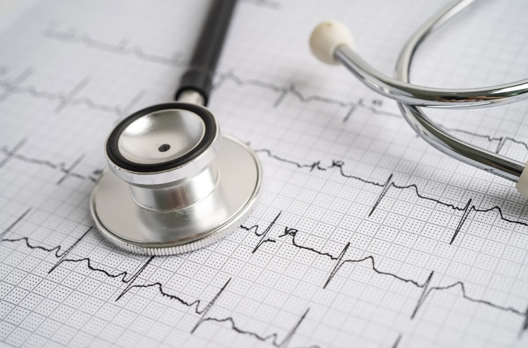 Stethoskop auf einem EKG-Diagramm, dargestellt in einem medizinischen Kontext zur Überwachung und Diagnose von Herzaktivität, wie sie bei Routineuntersuchungen oder der Diagnose von Herzsymptomen verwendet wird.