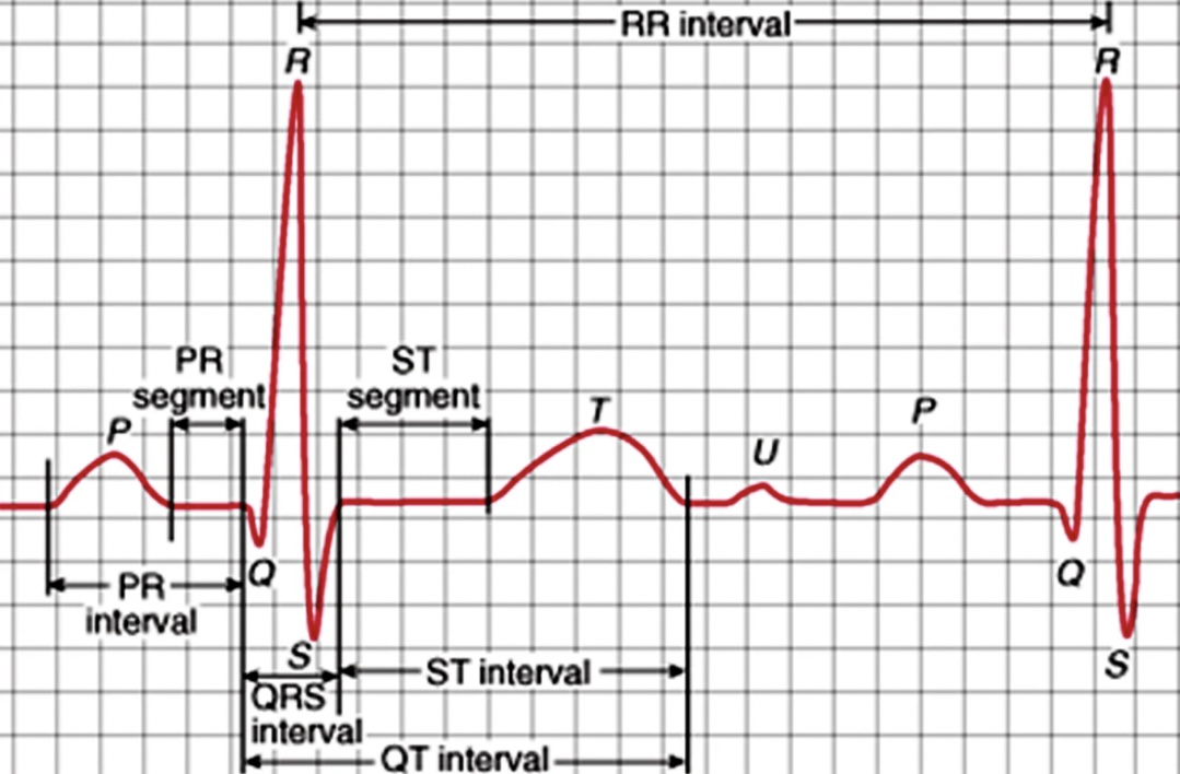 EKG-Diagramm mit markierten Intervallen, das die elektrischen Phasen eines Herzschlags zeigt, einschließlich P-Welle, QRS-Komplex und T-Welle zur Analyse der Herzfunktion.