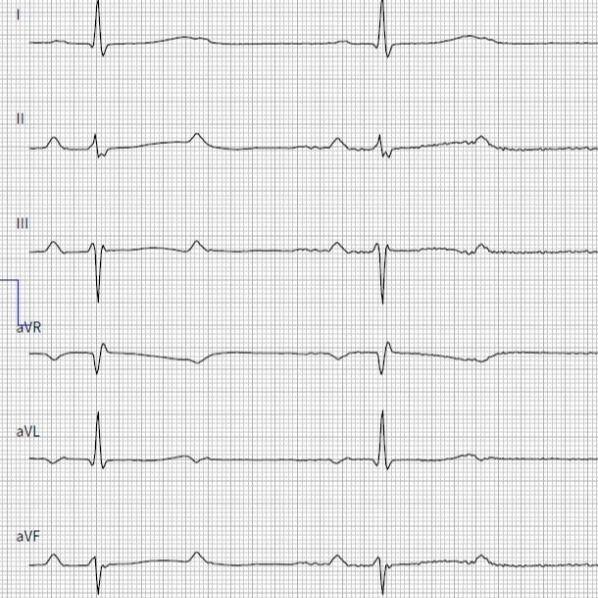 Ruhe-EKG-Untersuchung eines Patienten.