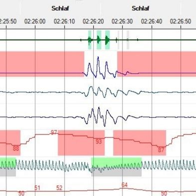 Mann während eines Schlafapnoe-Screenings mit tragbarem Gerät